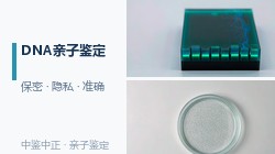 宁夏个人DNA亲子鉴定如何办理地址咨询