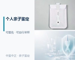 宁夏匿名亲子鉴定怎么收费，宁夏私密亲子鉴定结果多久出来